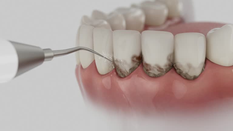 Reliable Dental Implants contractor in Rialto, CA by Smile Center Dentistry